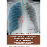 The Unofficial Guide to Radiology: 100 Practice Chest X-Rays- with Full Colour Annotations and Full X-Ray Reports…